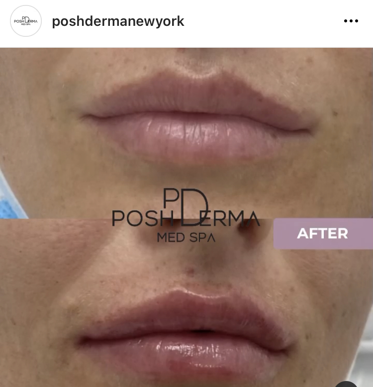 Posh Derma Med Spa | 2231 Central Park Ave, Yonkers, NY 10710, USA | Phone: (914) 639-2424