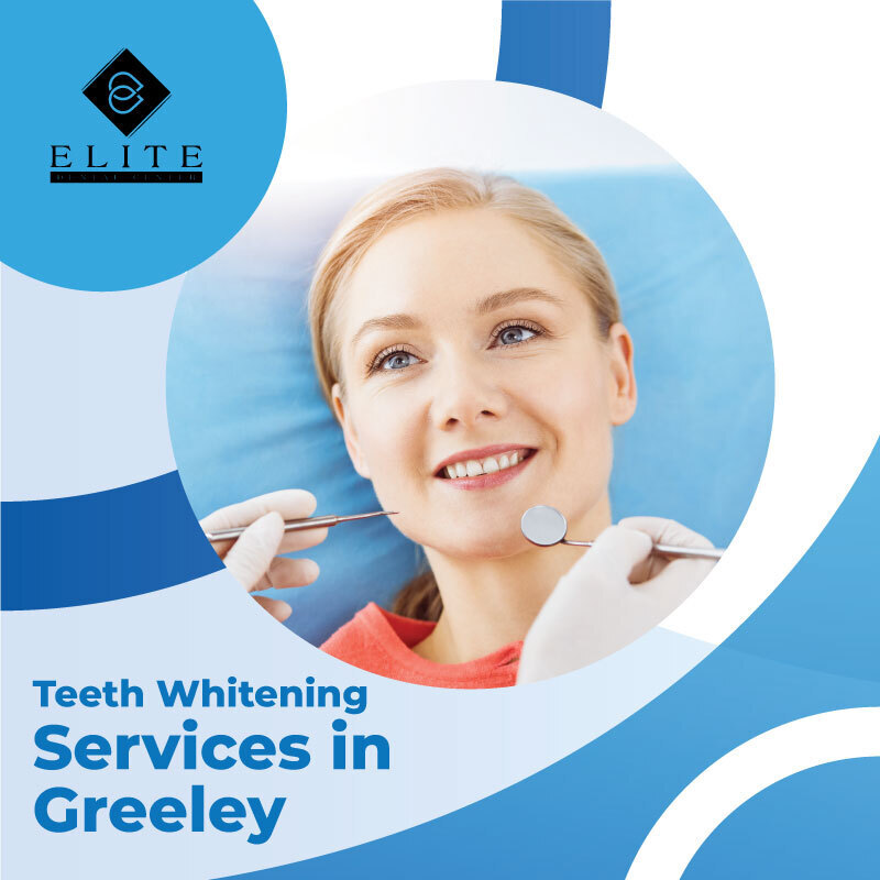 Elite Dental Center - dentist  | Photo 8 of 17 | Address: 2855 35th Ave Suite B, Greeley, CO 80634, United States | Phone: (970) 660-0925