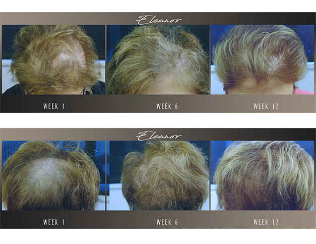 Lotus 39 Hair and Scalp Rejuvenation Formula | 34515 Mills Rd, North Ridgeville, OH 44039, USA | Phone: (440) 201-9395