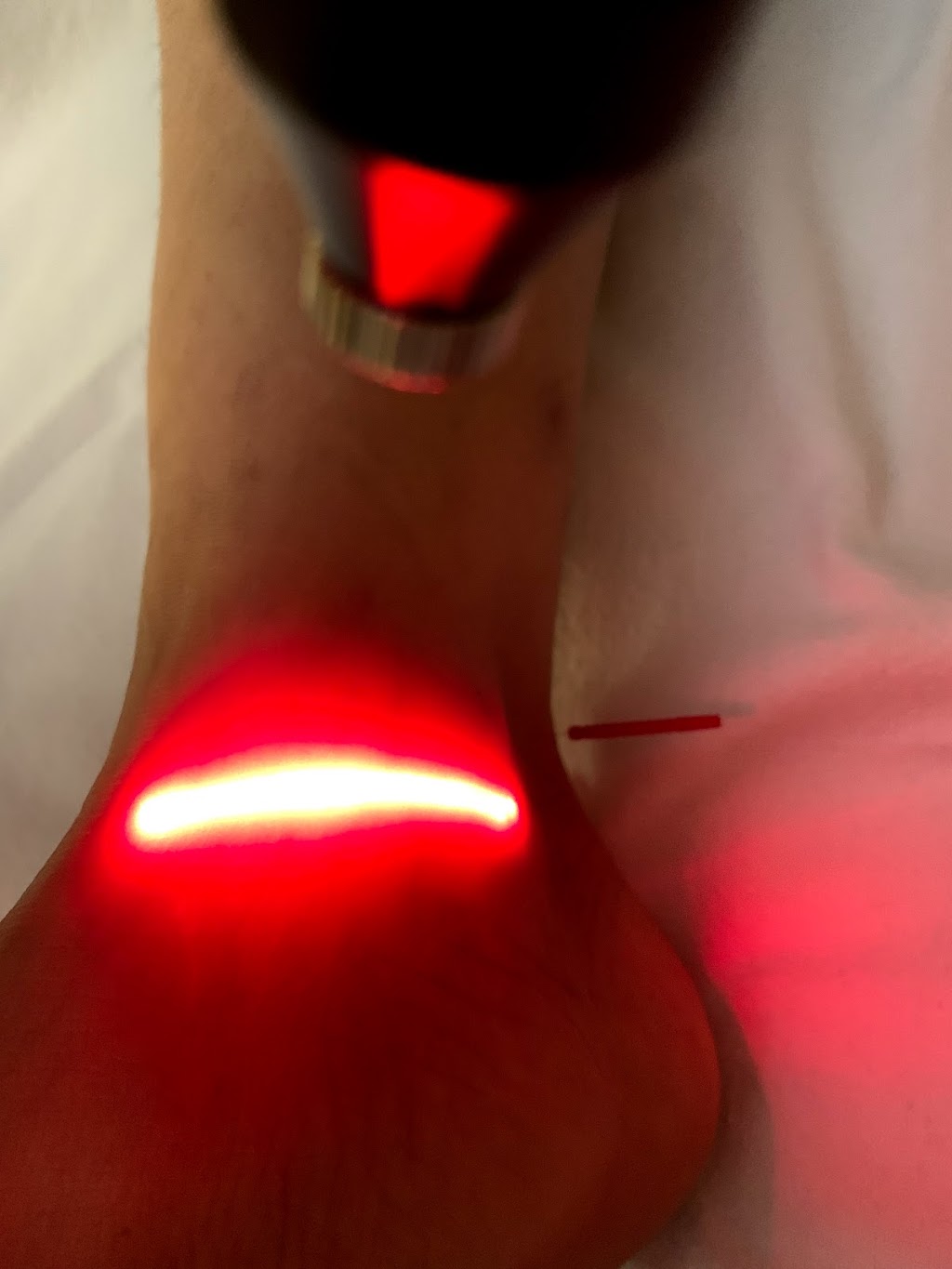 COCOR Acupuncture Health Clinic | 21040 Homestead Rd Suite 102, Cupertino, CA 95014, USA | Phone: (669) 271-0813