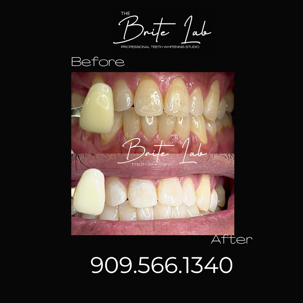The Brite Lab Teeth Whitening | 22597 Barton Rd Ste. D, Grand Terrace, CA 92313, USA | Phone: (909) 566-1340