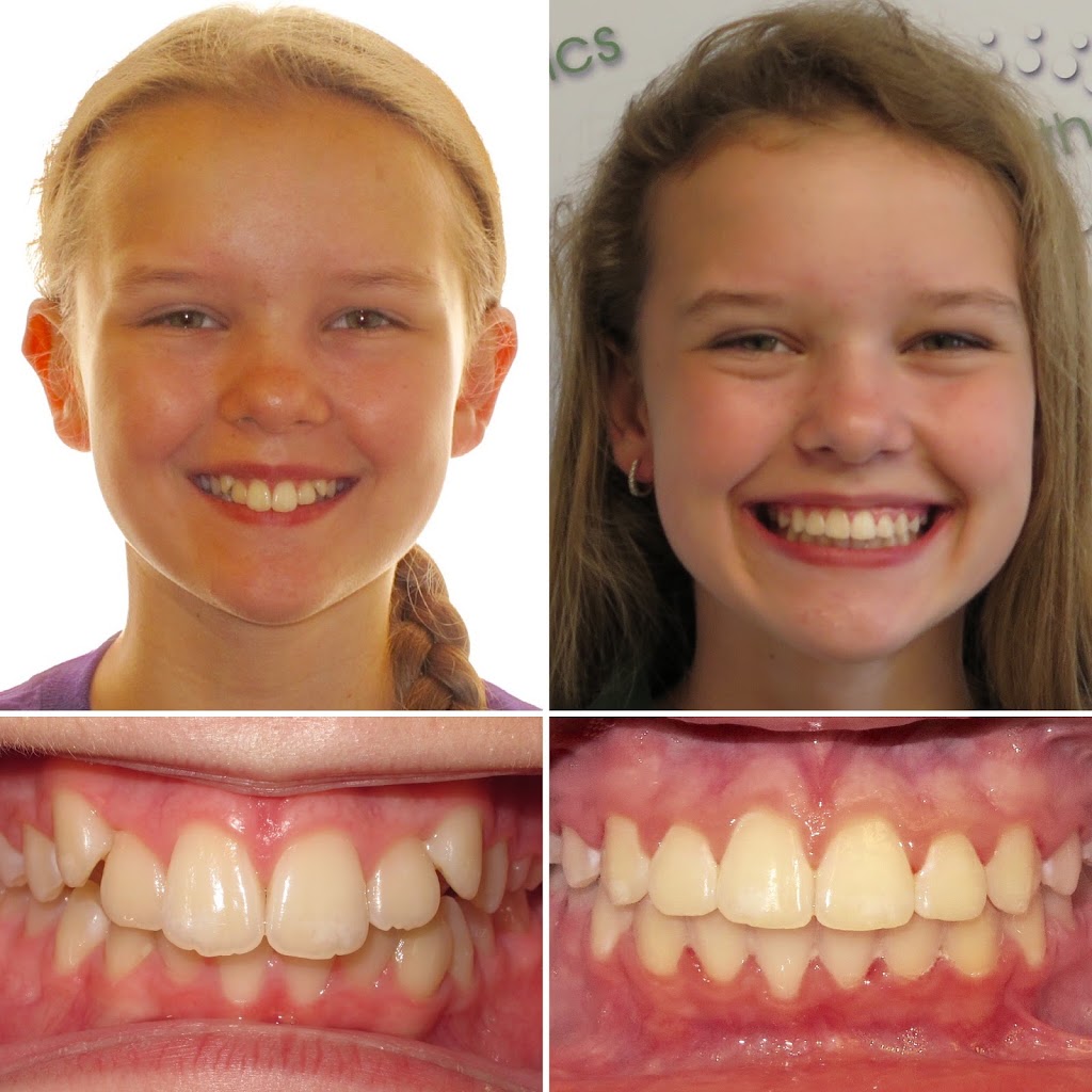 Henn Orthodontics | 4816 Greenwood Rd, Louisville, KY 40258, USA | Phone: (502) 935-7212