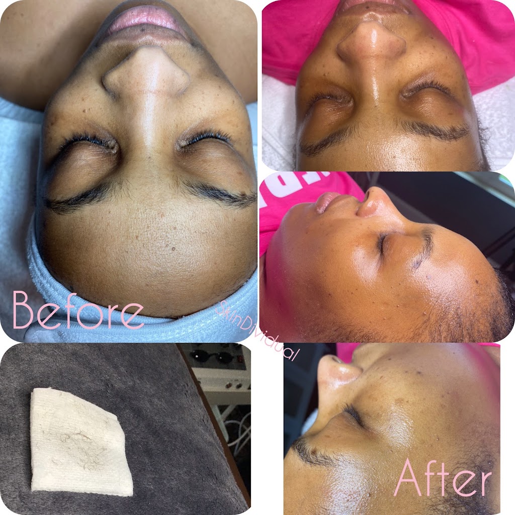 SkinDividual Skincare Studio | Carlisle Ave, Baltimore, MD 21216, USA | Phone: (443) 780-4808