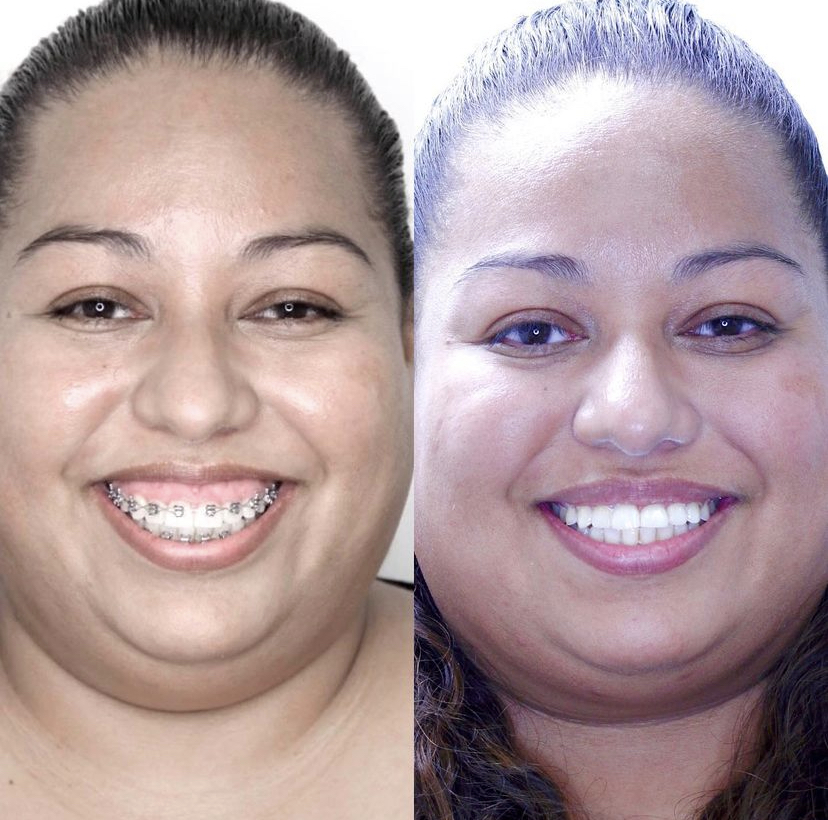 Orthodontics LA | 2270 E Colorado Blvd, Pasadena, CA 91107, USA | Phone: (626) 566-8558