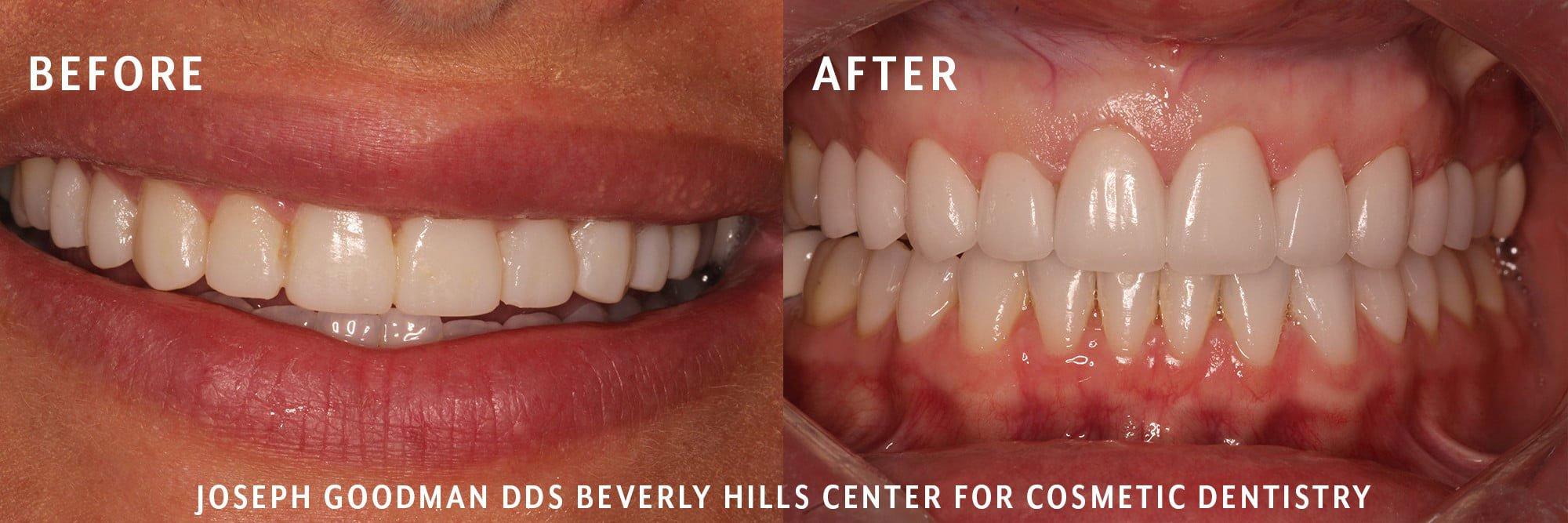 Dr. Joseph Goodman | Beverly Hills Dentist | 241 1/2 S Beverly Dr Suite 201, Beverly Hills, CA 90212, United States | Phone: (310) 860-9311