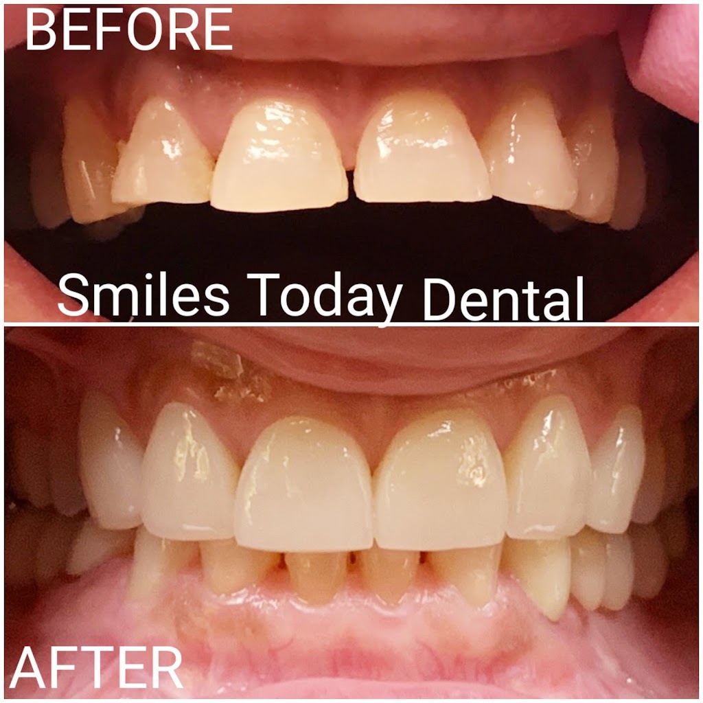 Smiles Today Dental | 3225 S Rainbow Blvd #104, Las Vegas, NV 89146, USA | Phone: (702) 655-6777
