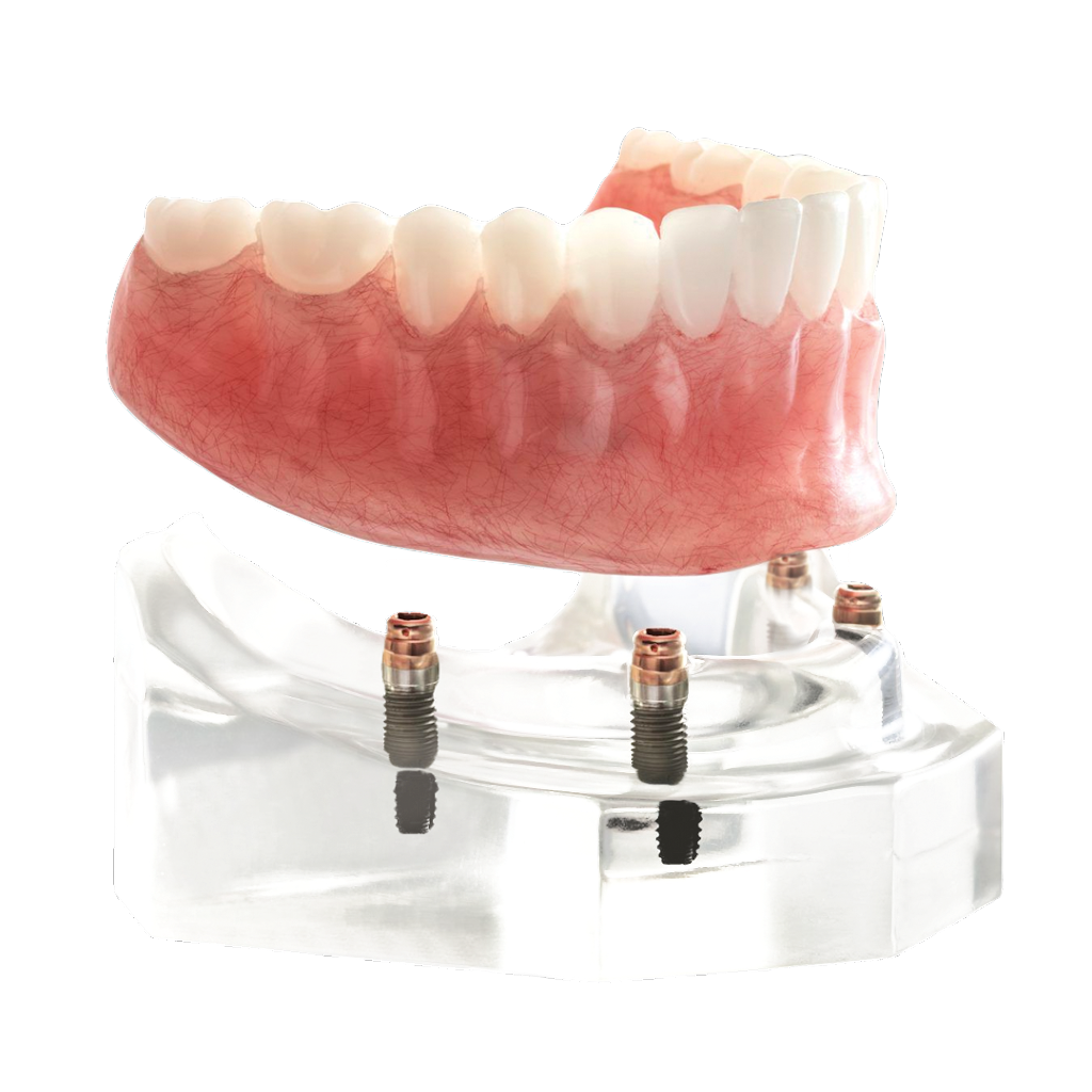 DDS Dentures + Implant Solutions of Manor | 12700 Lexington St Ste 220, Manor, TX 78653 | Phone: (512) 648-6995