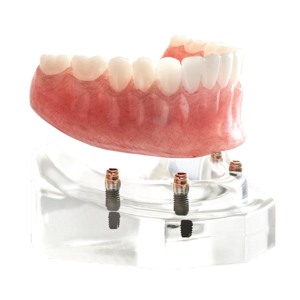 DDS Dentures + Implant Solutions of Manor | 12700 Lexington St Ste 220, Manor, TX 78653, USA | Phone: (512) 648-6995