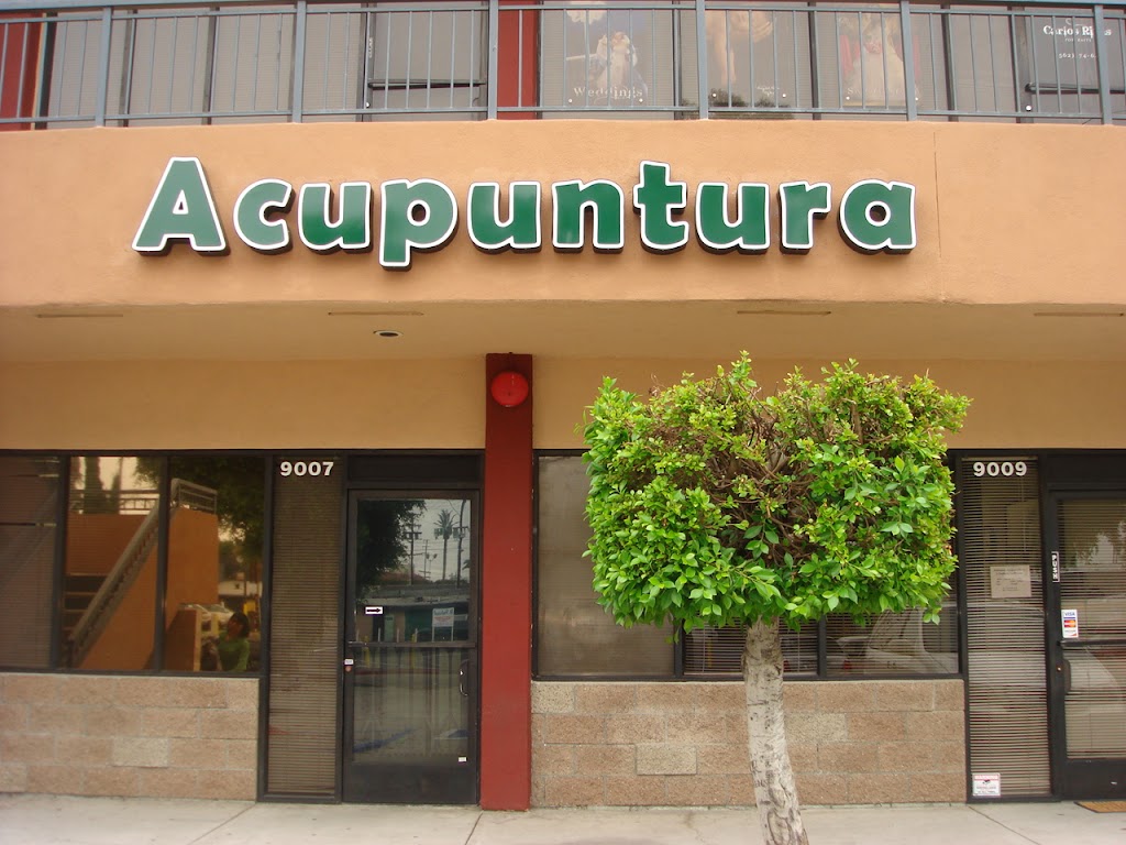 Natuever Acupuncture | 9007 Telegraph Rd, Pico Rivera, CA 90660, USA | Phone: (562) 440-0358