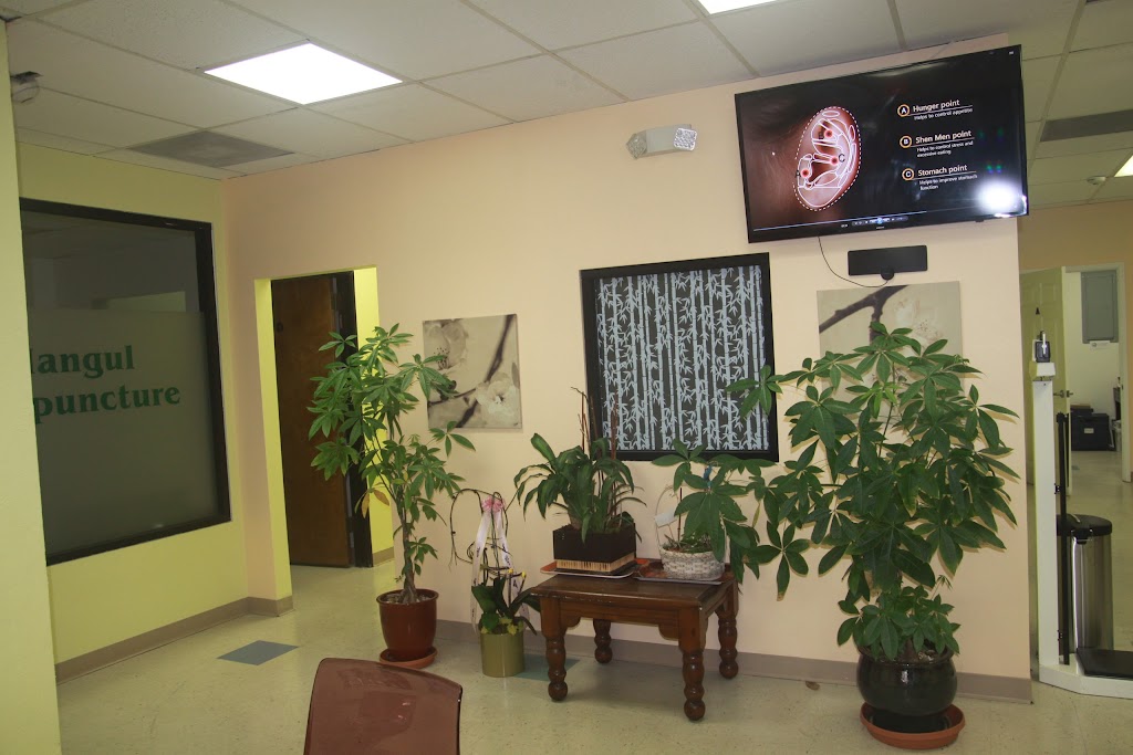 Hangul Acupuncture | 7860 Imperial Hwy. A, Downey, CA 90242, USA | Phone: (562) 869-8877