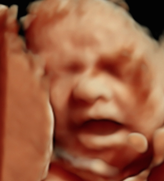 Keepsake Prenatal Imagaing 3D/4D HD Ultrasound Studio | 5656 US-29, Blairs, VA 24527, USA | Phone: (434) 429-1069