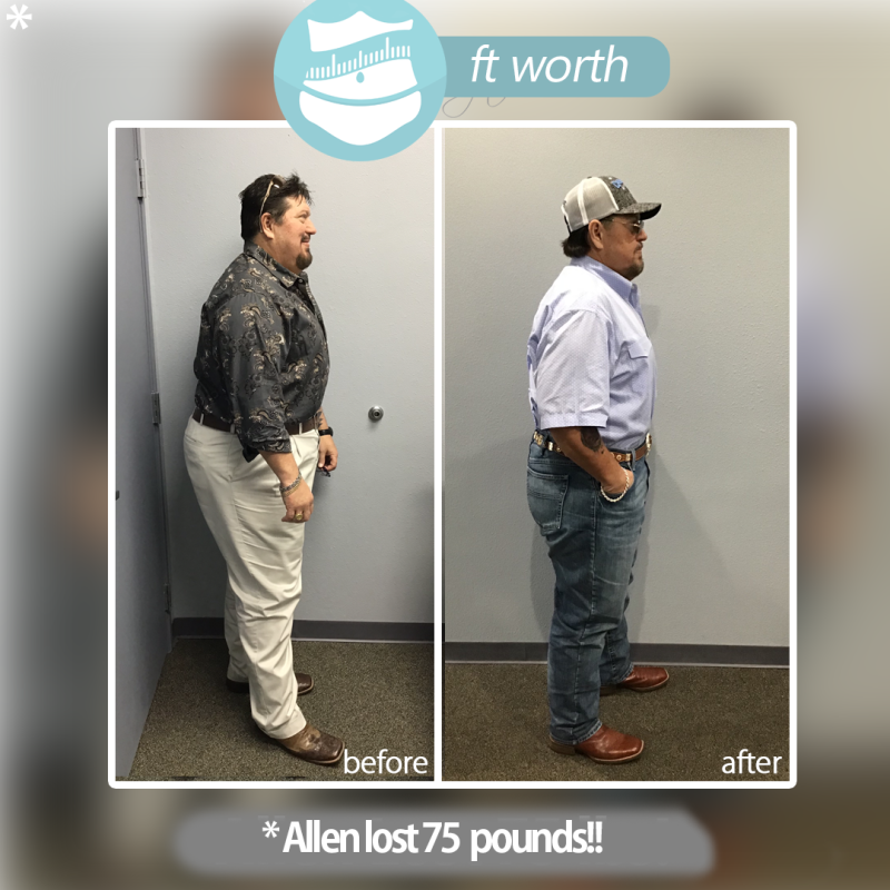 Renown Weight Loss McKinney | 1701 Eldorado Pkwy STE 202, McKinney, TX 75069, USA | Phone: (469) 496-8980