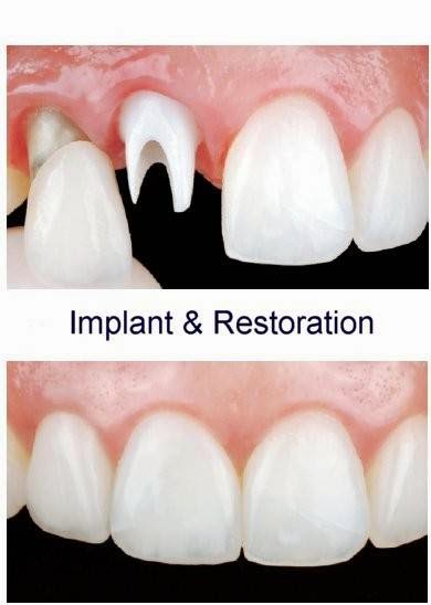 Thanh-Truc Nguyen, DDS | 5400 Park Dr #100, Rocklin, CA 95765, USA | Phone: (916) 435-1155