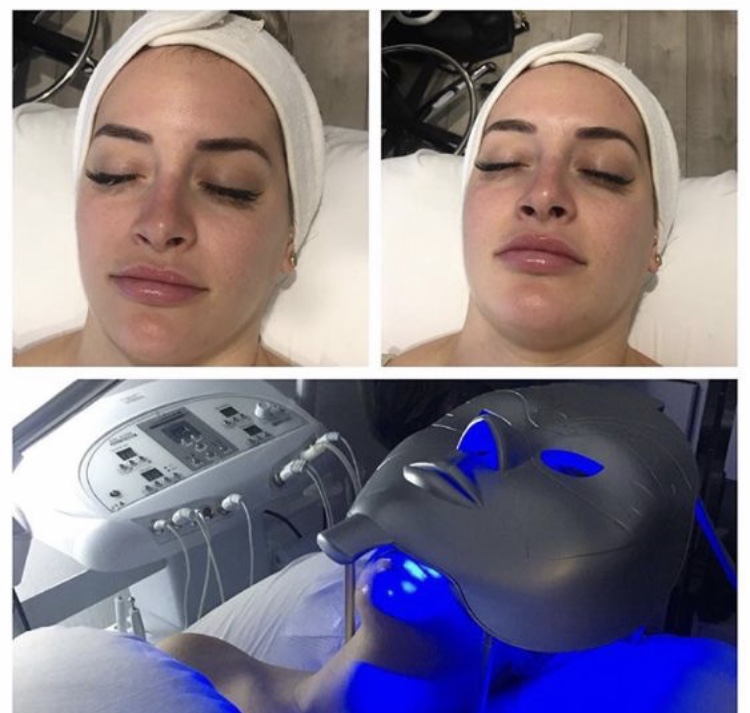 Skin Care by Anna | 12410 Burbank Blvd # 103, Valley Village, CA 91607, USA | Phone: (818) 414-7151