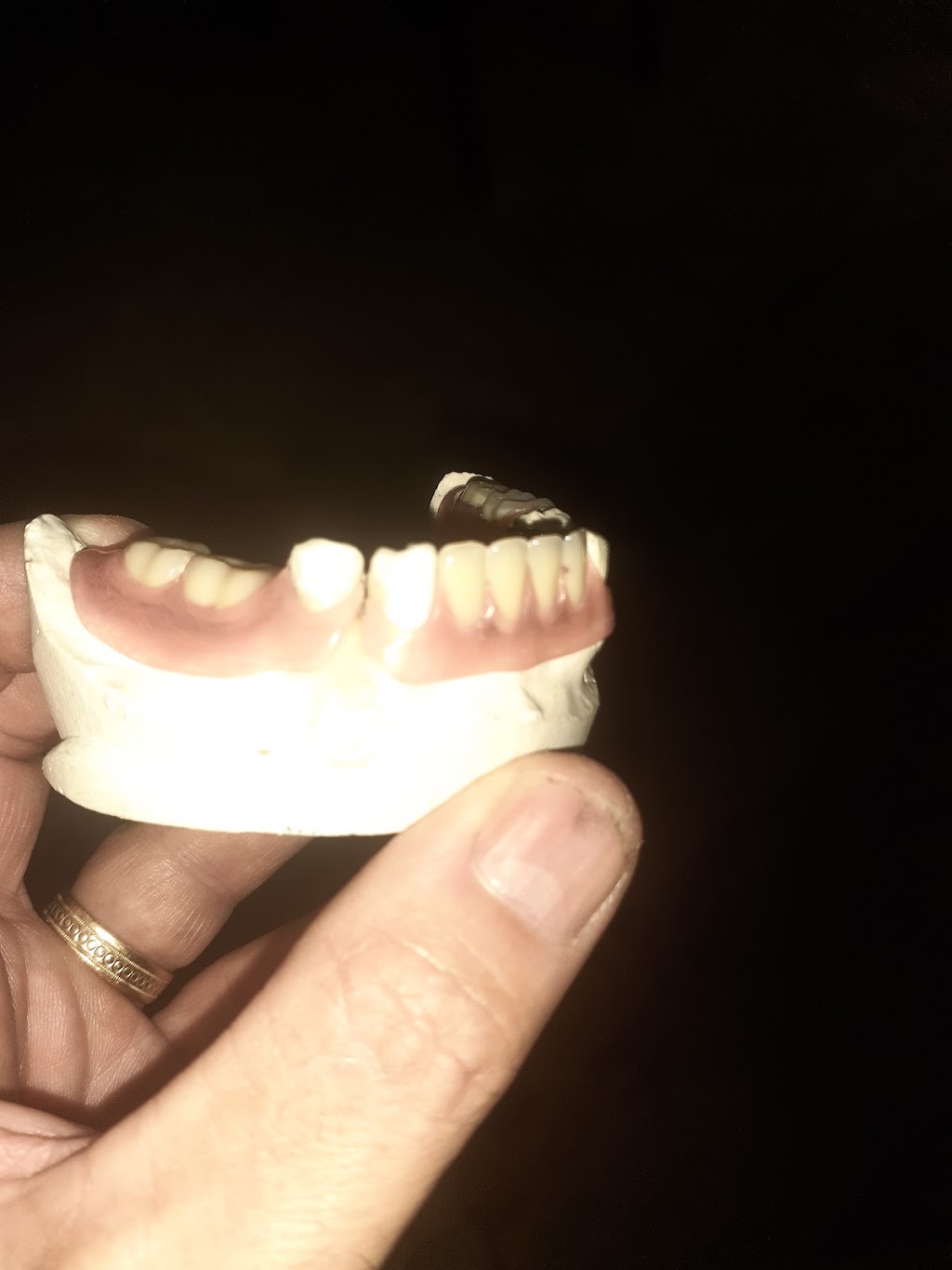 R&B Dental Lab | 21374 Ramona Ave, Apple Valley, CA 92307, USA | Phone: (760) 261-2425