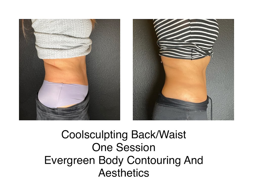 Evergreen Body Contouring | 4011 Evergreen Pkwy, Evergreen, CO 80439, USA | Phone: (720) 366-8419