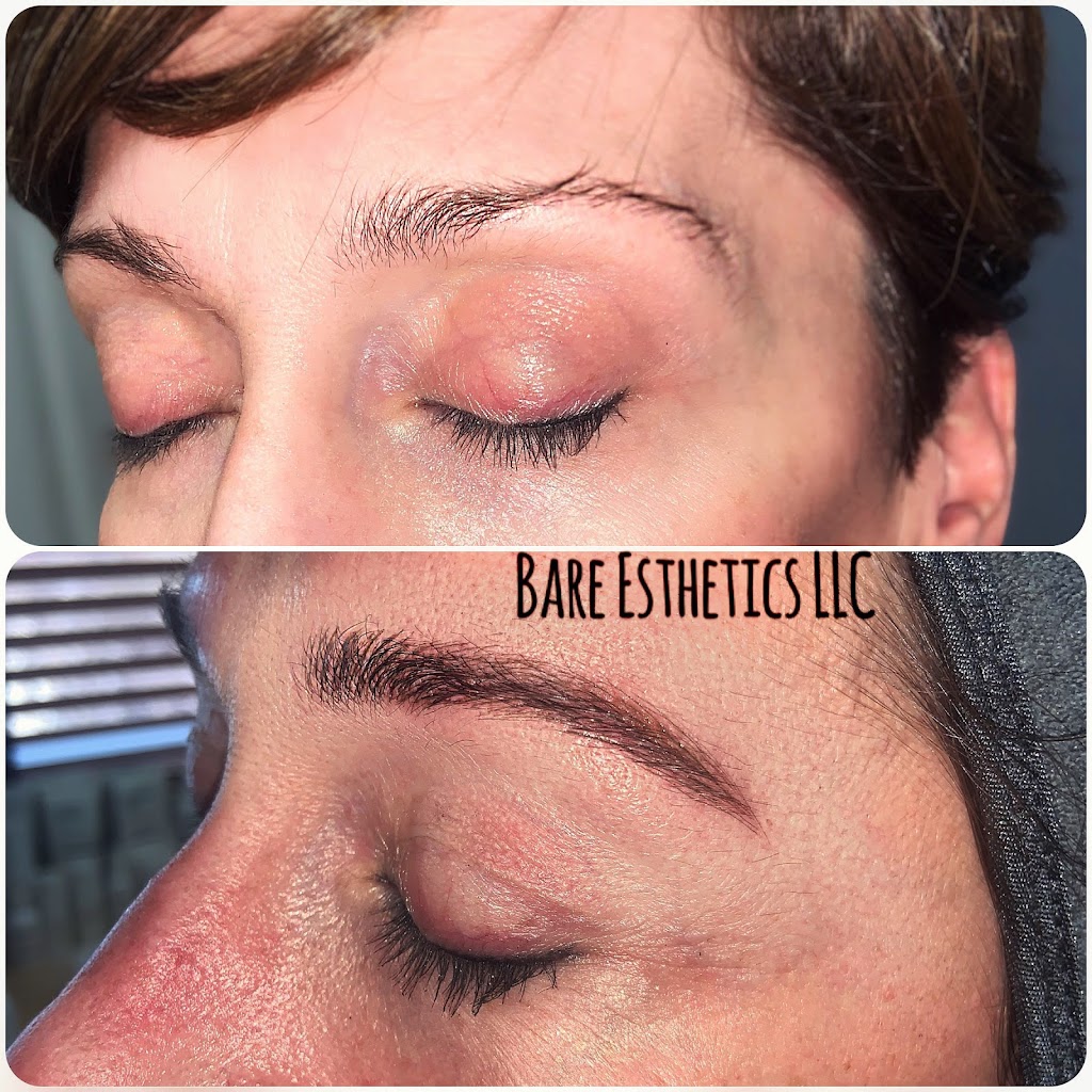 Bare Esthetics | 5370 Main St Saint, Cottleville, MO 63304 | Phone: (314) 454-9840