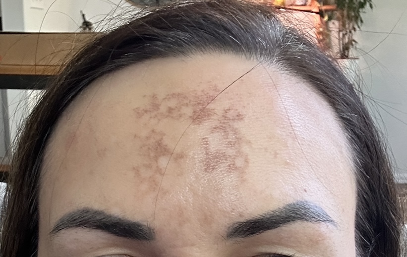 SkinCare Austin | 102 Westlake Dr #101, Austin, TX 78746, USA | Phone: (512) 327-2227