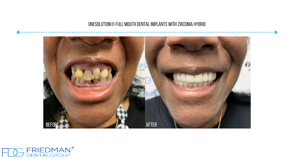 Teeth in a Day Florida | 7420 NW 5th St #109, Plantation, FL 33317, USA | Phone: (866) 341-6395