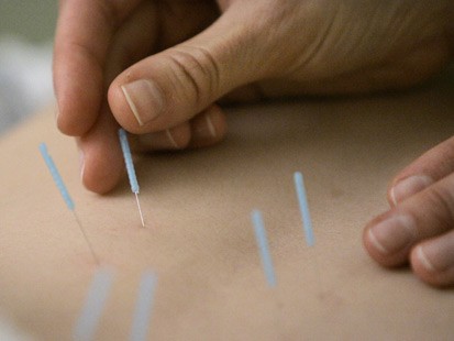 Aahom Acupuncture | 705 Northeast Dr #14, Davidson, NC 28036, USA | Phone: (704) 737-4412