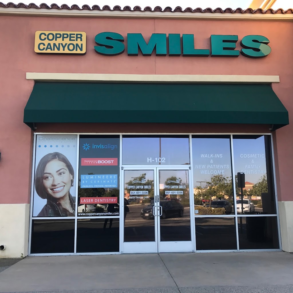 Copper Canyon Smiles | Dentist in Murrieta | 23771 Washington Ave Ste H-102, Murrieta, CA 92562, USA | Phone: (951) 691-5096