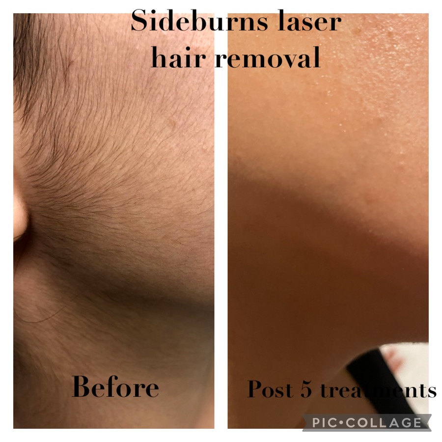 Flawless Skin & Laser Solutions | 17035 N 67th Ave #9, Glendale, AZ 85308, USA | Phone: (623) 521-4671