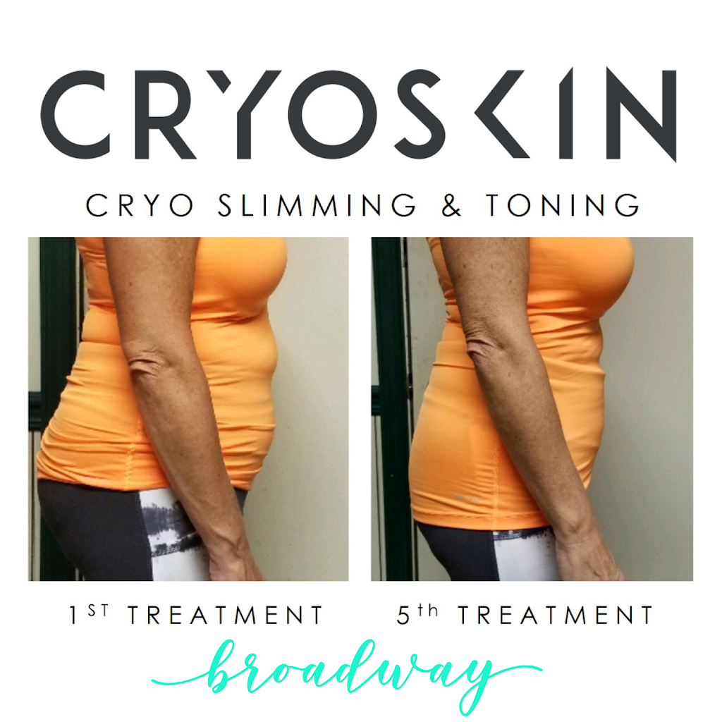 Broadway Cryoskin | 763 S Main St, Orange, CA 92868, USA | Phone: (949) 409-1160