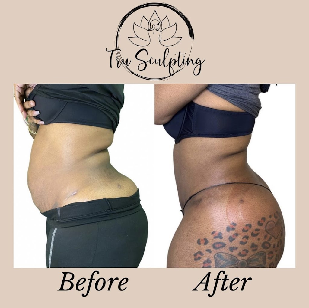 Tru Sculpting Health & Beauty | 2201 E Willow St # H, Signal Hill, CA 90755, USA | Phone: (562) 481-4392 Tru Sculpting Health & Beauty | 2201 E Willow St # H, Signal Hill, CA 90755, USA | Phone: (562) 481-4392