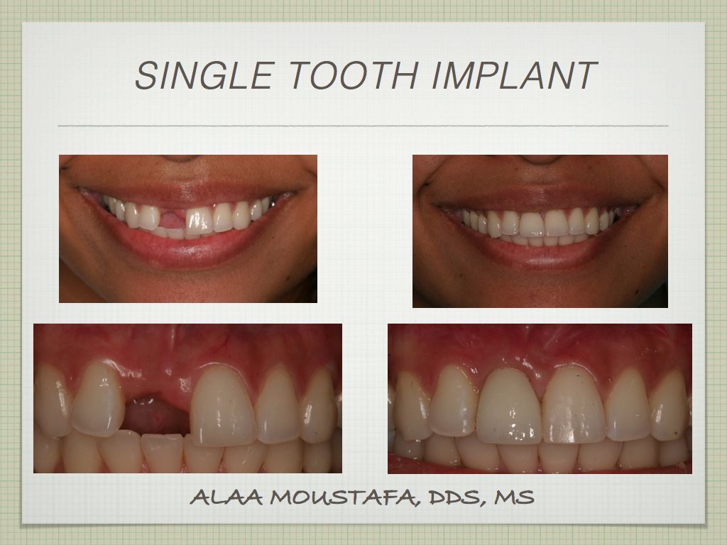 Alaa Moustafa, DDS, MS | 47 Penny Ln, Watsonville, CA 95076, USA | Phone: (831) 724-4539