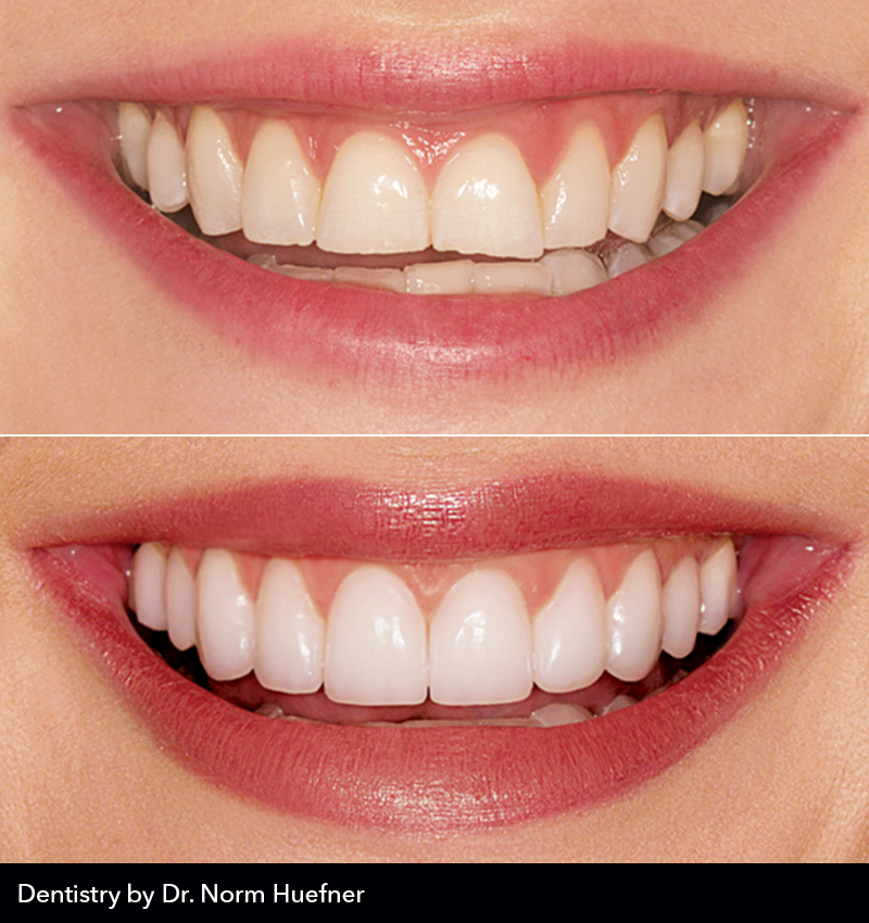 MicroDental Las Vegas Laboratory | 1401 Hillshire Dr # 110, Las Vegas, NV 89134, USA | Phone: (702) 458-1079