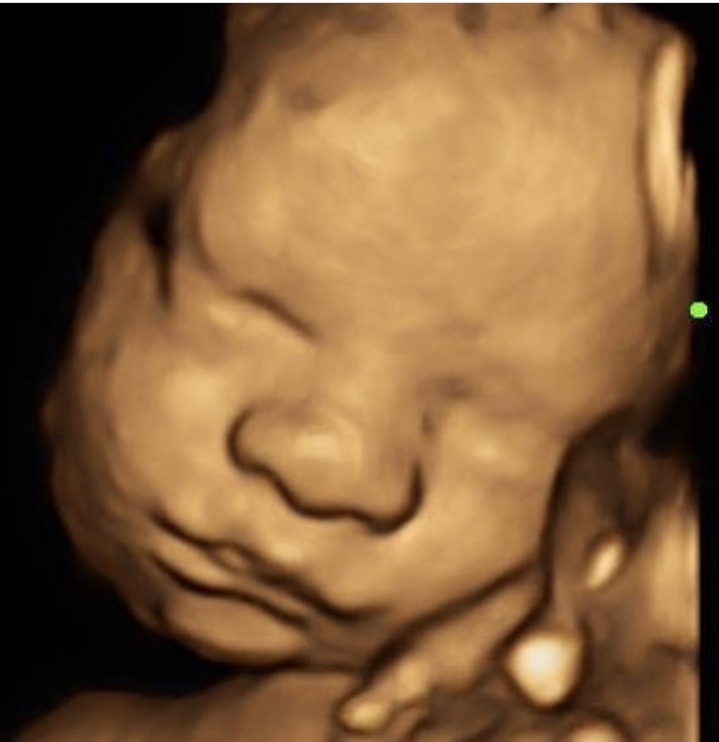 Stork Vision Dallas 3D/4D/HD Ultrasound | 3317 McKinney Ave # 201, Dallas, TX 75204, USA | Phone: (469) 999-8630