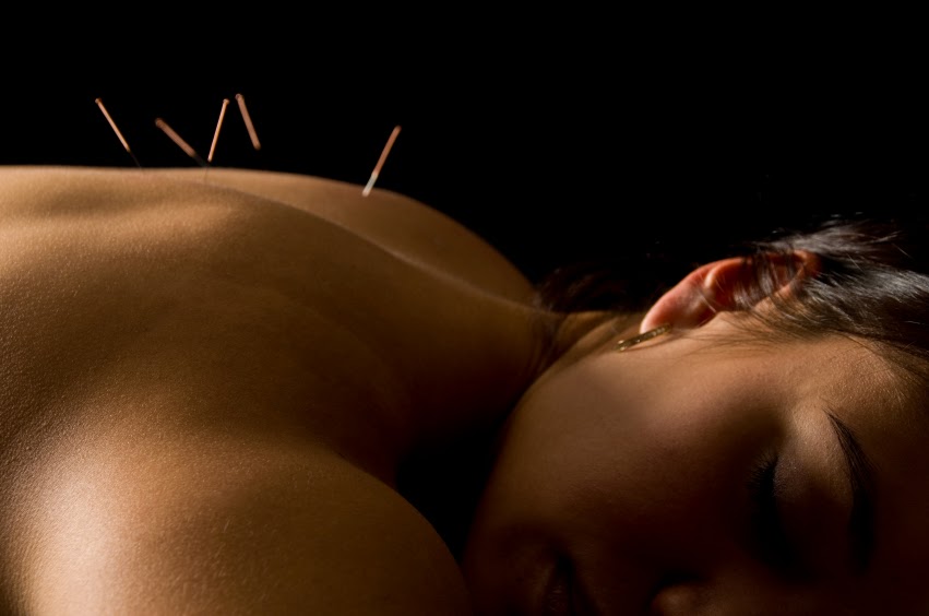 Acu-Care Acupuncture Clinic, Inc | 6633 N Mesa St, El Paso, TX 79912, USA | Phone: (915) 585-6222