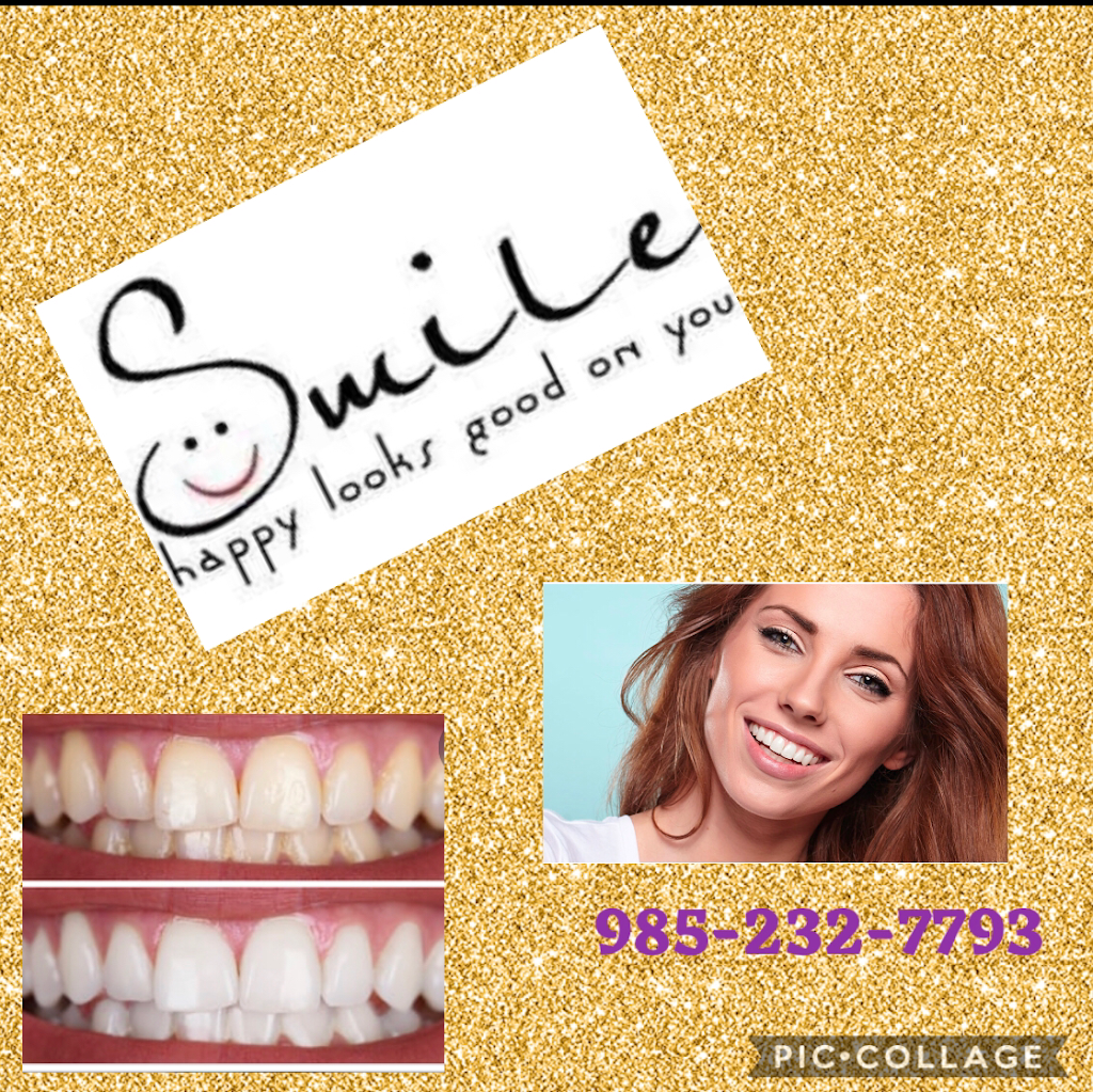 Smile Labs of Houma LLC | 112 Equity Blvd #102, Houma, LA 70360, USA | Phone: (985) 232-7793