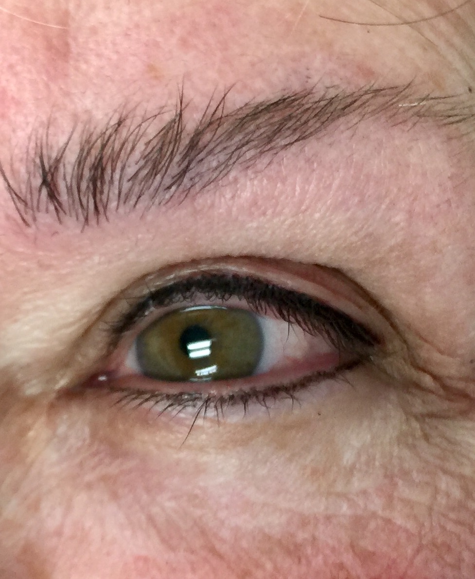 Your Body Your Skin | 1325 Riley St Ste. 212, Folsom, CA 95630, USA | Phone: (916) 201-9723