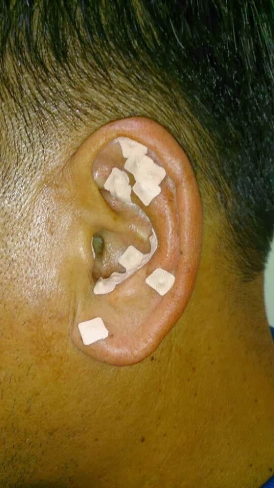 Reishi Acupuncture Clinic | 419 W Las Tunas Dr, San Gabriel, CA 91776, USA | Phone: (626) 382-6607 Reishi Acupuncture Clinic | 419 W Las Tunas Dr, San Gabriel, CA 91776, USA | Phone: (626) 382-6607