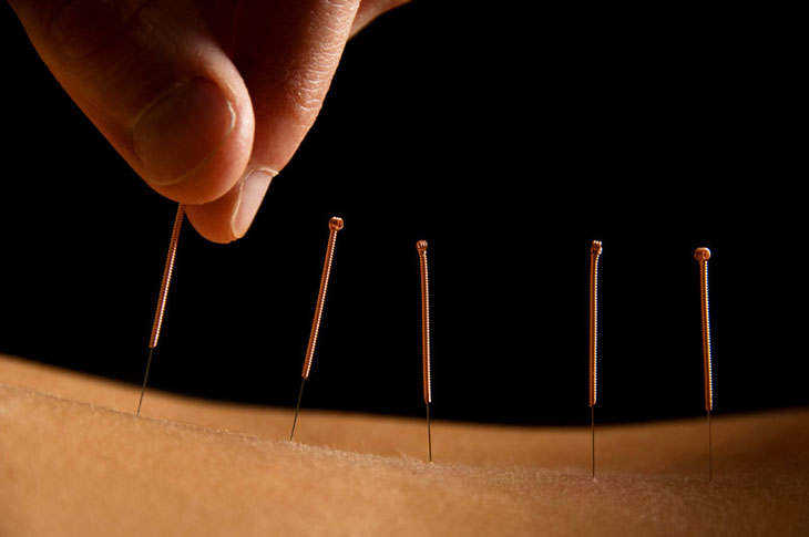 Balance Acupuncture & Wellness Center | 261 School Ave Suite 220(D, Excelsior, MN 55331, USA | Phone: (763) 370-9086