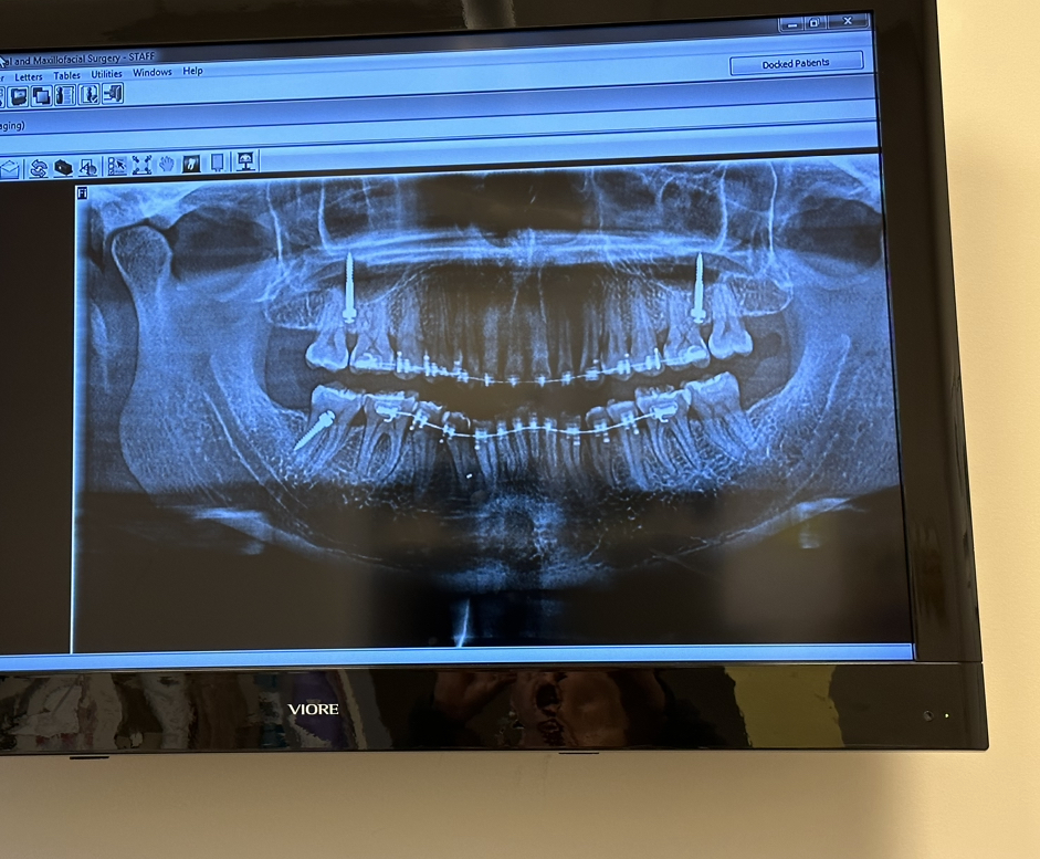 Southern Oral Surgery | 874 W Lanier Ave W #101, Fayetteville, GA 30214, USA | Phone: (770) 471-4196