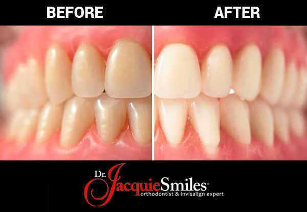 Dr. Jacquie Smiles | 70 Gilbert St 202 Suite 23, Monroe, NY 10950, USA | Phone: (845) 782-4288