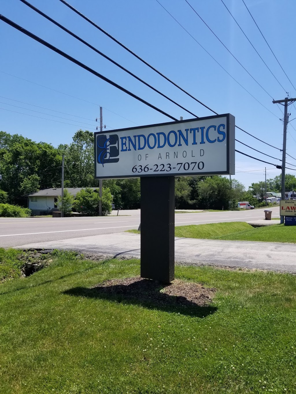 Endodontics Of Arnold | 4123 Jeffco Blvd, Arnold, MO 63010, USA | Phone: (636) 223-7070