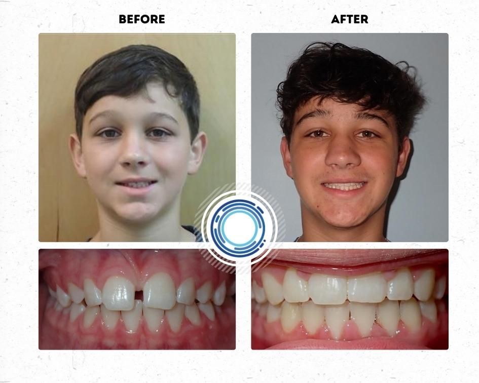 Novus Orthodontics | 650 Henderson Dr Suite 205, Cartersville, GA 30120, USA | Phone: (770) 487-8299