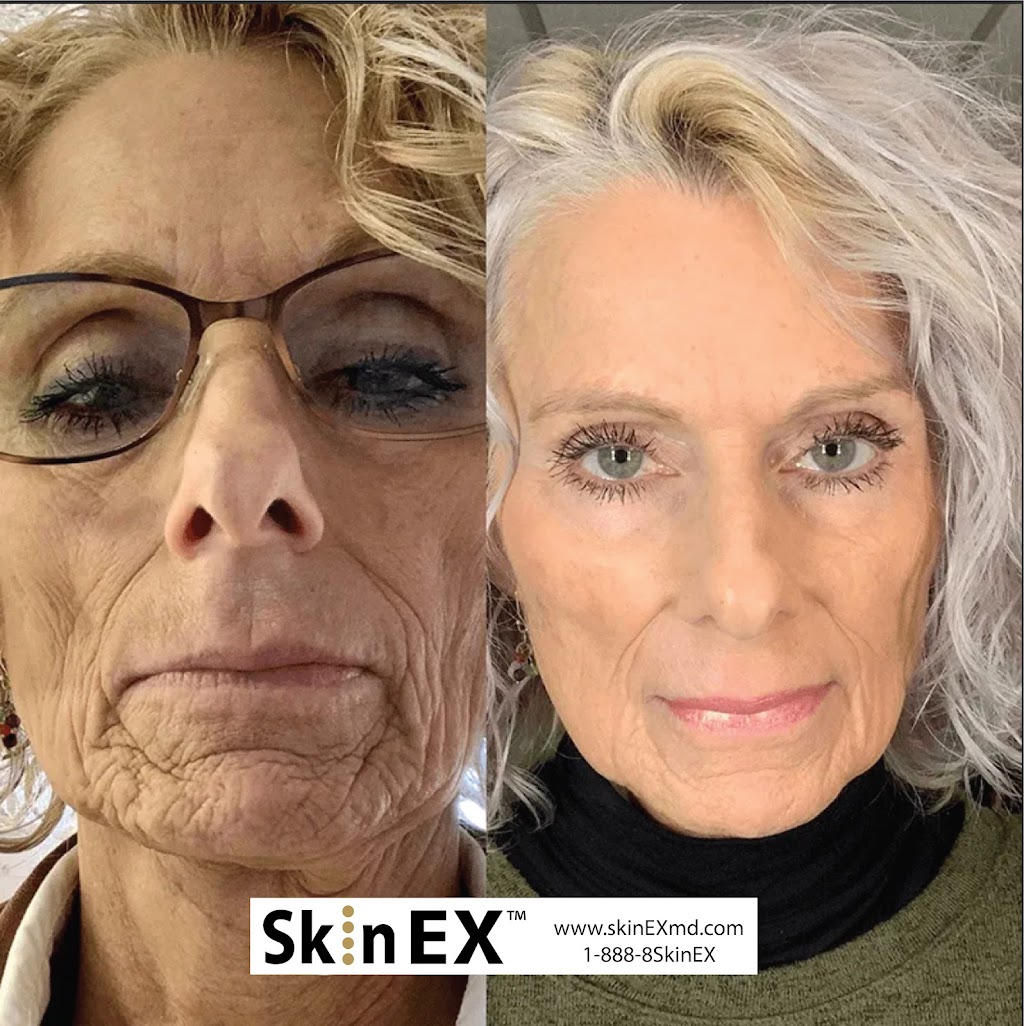 Skin EX Yorba Linda | 23052 Eastpark Dr Suite 1, Yorba Linda, CA 92887, USA | Phone: (888) 875-4639