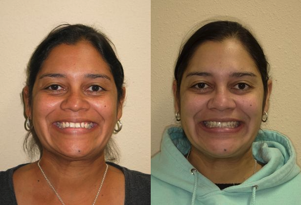 Hulme Orthodontics | 1314 Constantinople St, Castroville, TX 78009, USA | Phone: (210) 479-3026