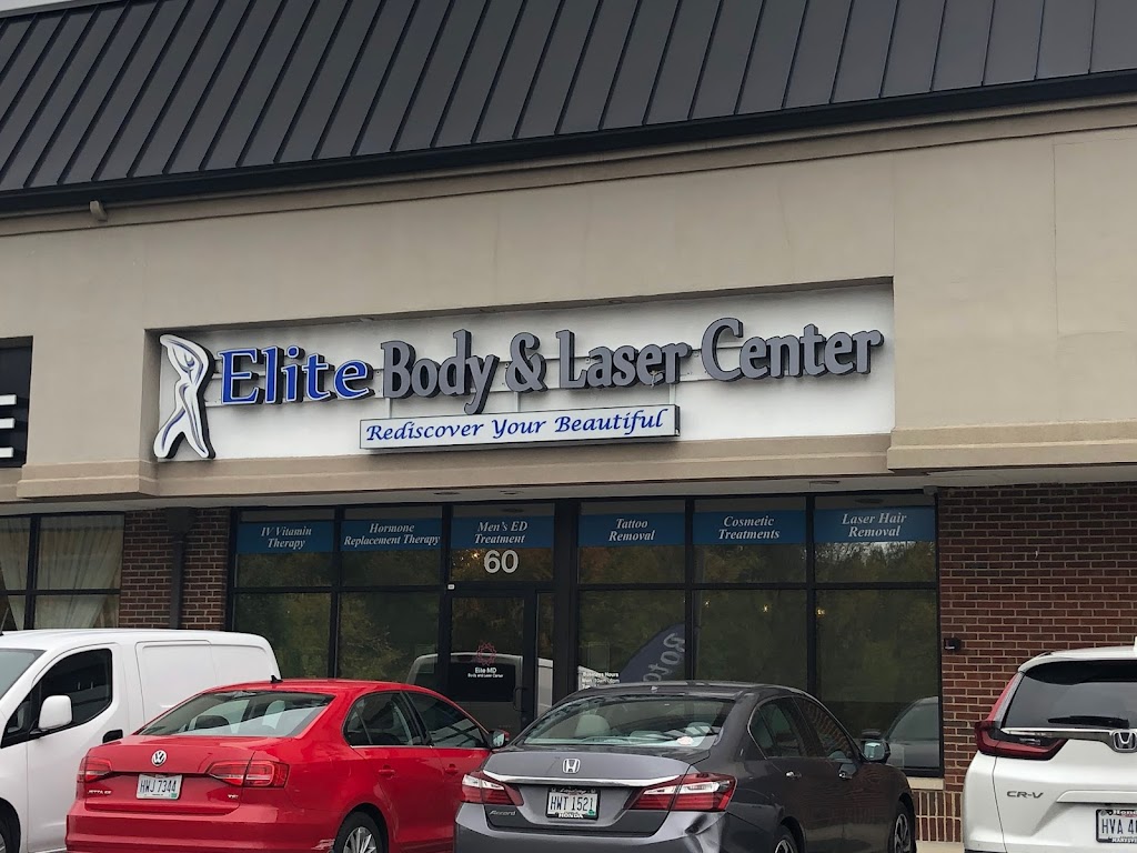 Elite Body and Laser Center | 60 Powell Rd, Lewis Center, OH 43035, USA | Phone: (614) 334-4944