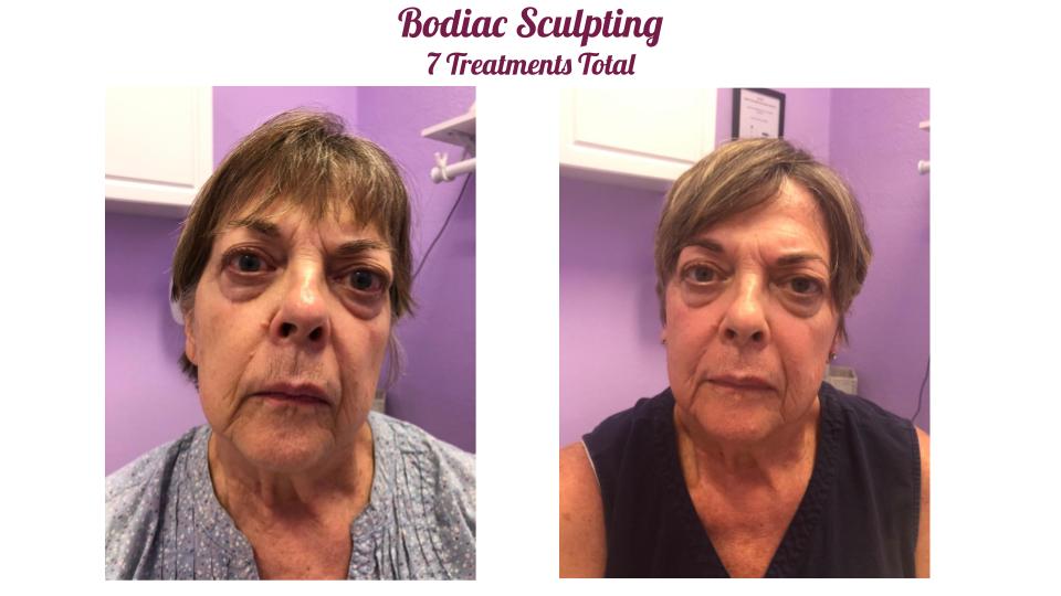 Bodiac Sculpting | 4855 Warner Rd Suite 23A, Phoenix, AZ 85044, USA | Phone: (480) 770-6271