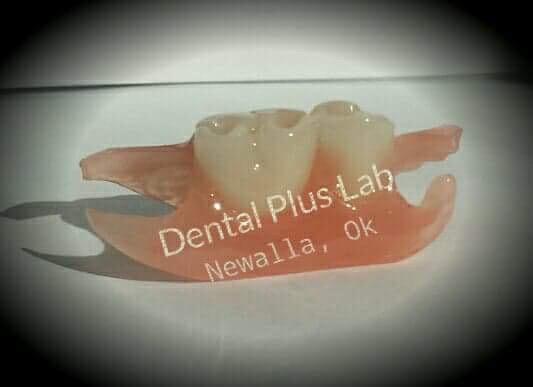 Dental Plus Laboratory Newalla, Ok | 16995 Woodside Dr, Newalla, OK 74857, USA | Phone: (405) 625-2735
