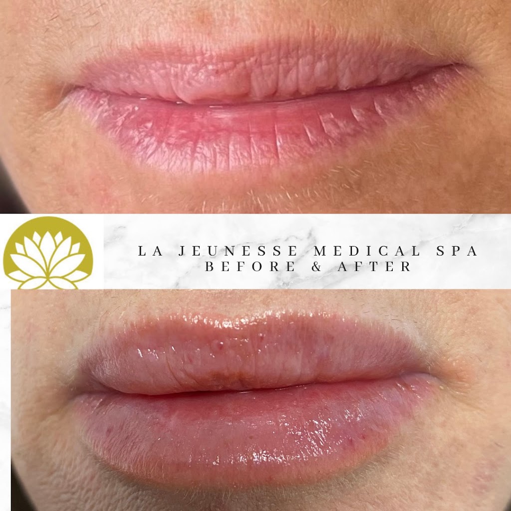 La Jeunesse Medical Spa | 16 Old Brookside Rd Unit 1, Randolph, NJ 07869, USA | Phone: (973) 384-1131