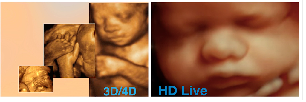 Babys First 4D Ultrasound | 5150 N 16th St b133, Phoenix, AZ 85016, USA | Phone: (602) 478-0806