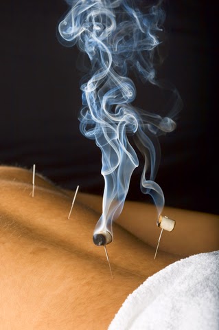 Revolution Acupuncture & Herbal Clinic | 331 N Wood Dale Rd, Wood Dale, IL 60191 | Phone: (630) 422-5232