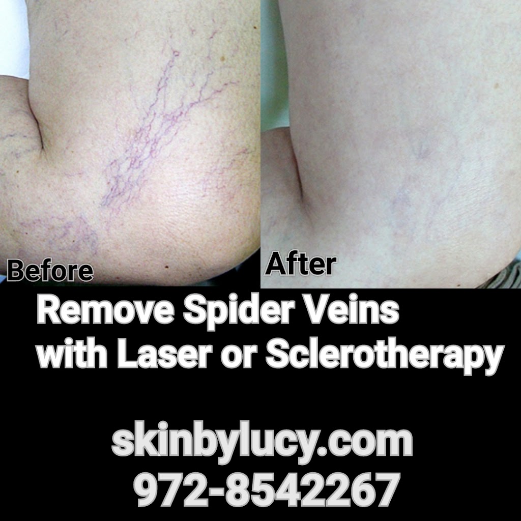 Skin by Lucy Med | 4222 Trinity Mills Rd, Dallas, TX 75287, USA | Phone: (972) 854-2267