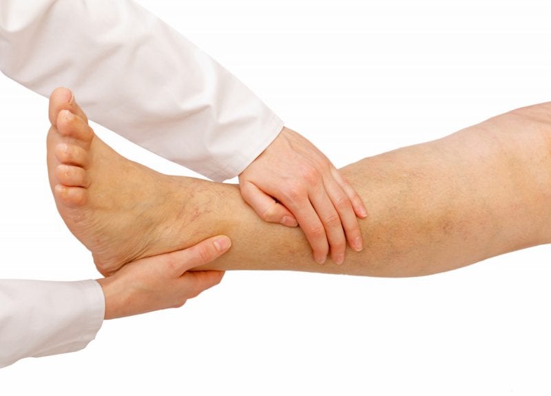 Comprehensive Vein Care | 311 Spotswood Englishtown Rd, Monroe Township, NJ 08831, USA | Phone: (732) 662-7934